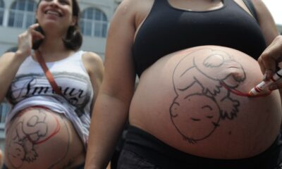 Fatores sociais e estruturais influenciam aumento de cesarianas entre mulheres
